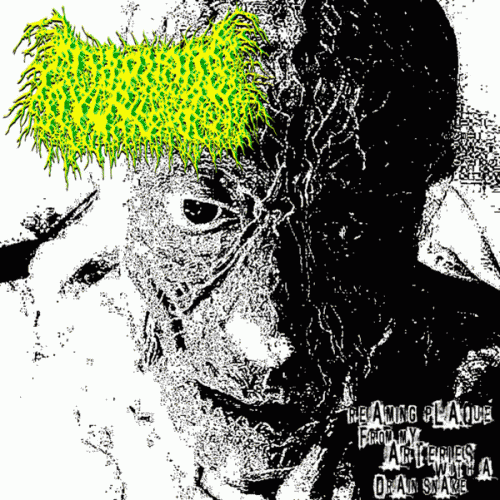 Reaming Plaque from My Arteries with a Drain Snake